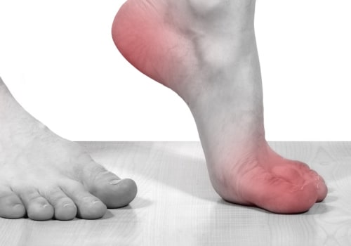Does cbd help with neuropathy in feet?